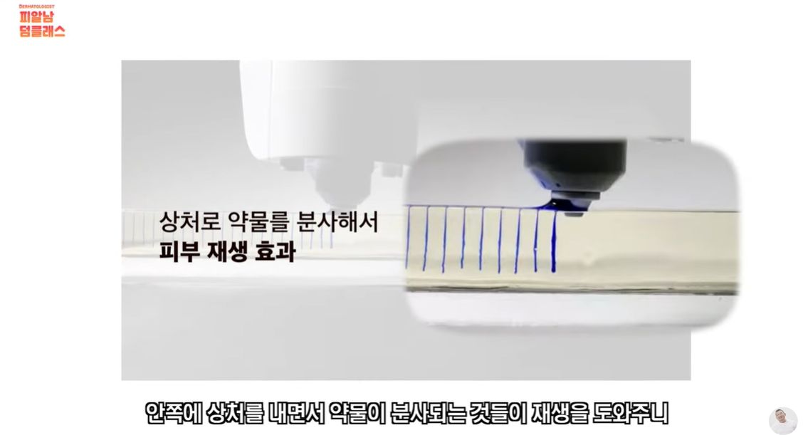 목주름과 모공에 효과적인 미라젯. 피알남 유튜브 캡처