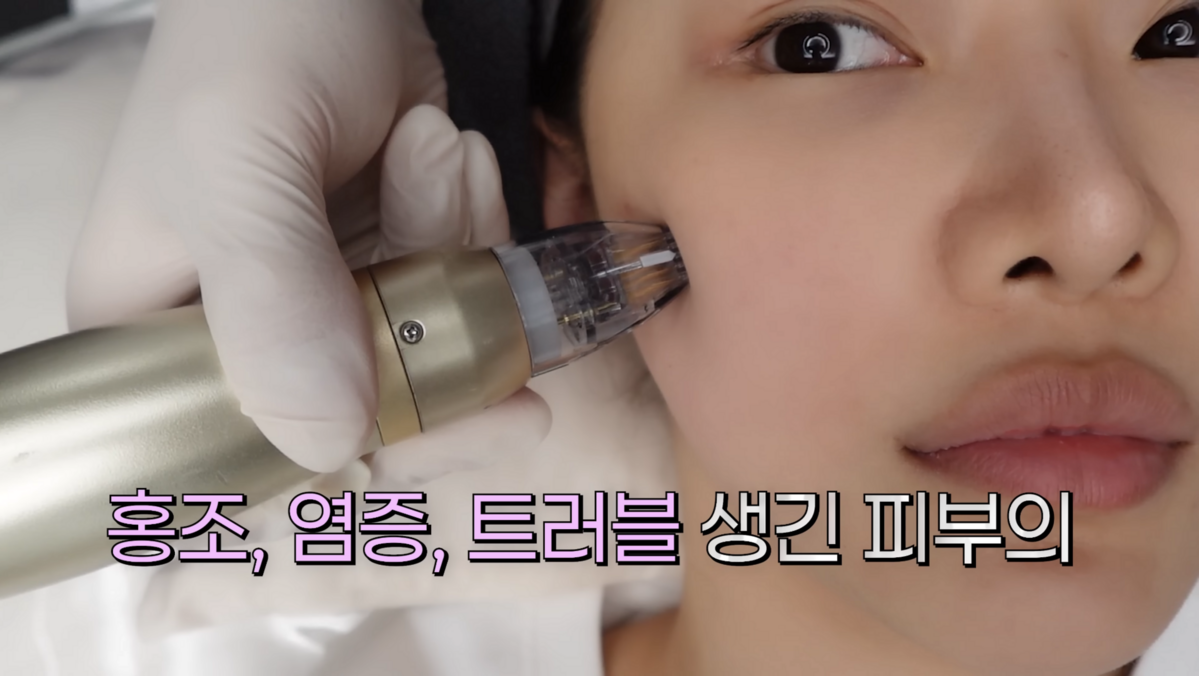 최종시안 유튜브 캡처