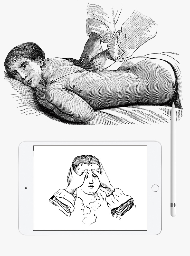 보 앙주 기본 관리 10회 1백40만원. 아이패드 미니는 50만원대 Apple.
