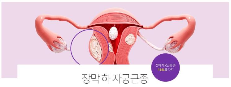 (c) 서울라헬여성의원