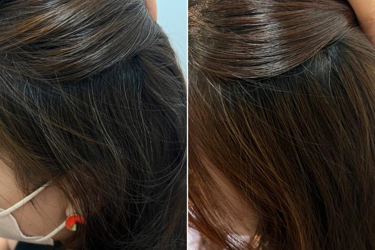 Before/ After