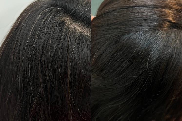 Before/ After