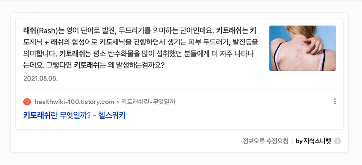 색소성 양진이란?