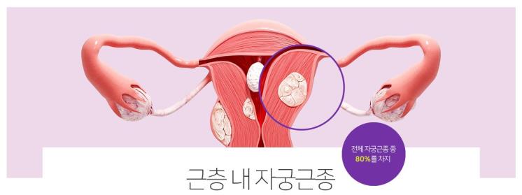 (c) 서울라헬여성의원