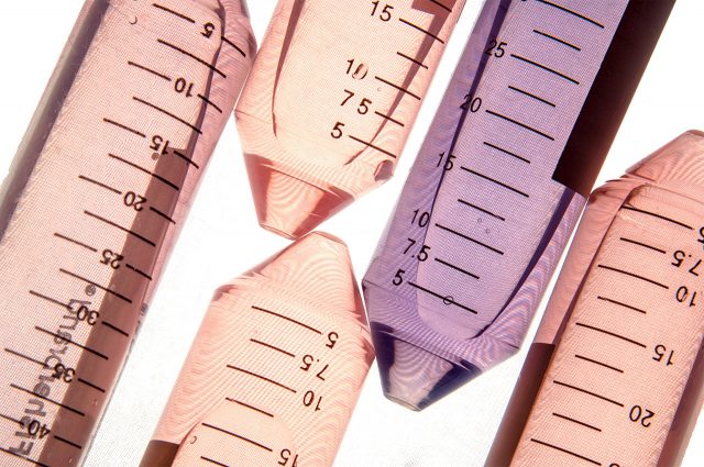 환경 호르몬이 미치는 영향 - 하퍼스 바자