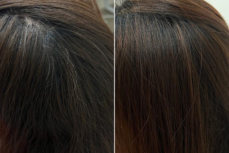Before/ After
