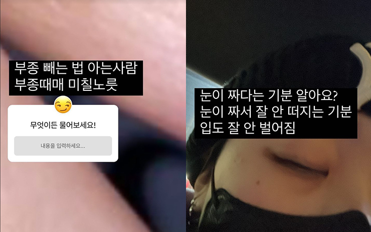 이영지