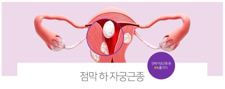 (c) 서울라헬여성의원