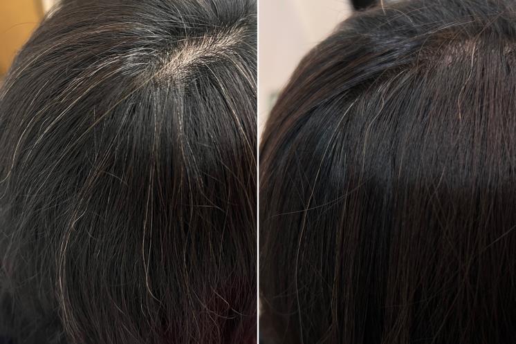 Before/ After